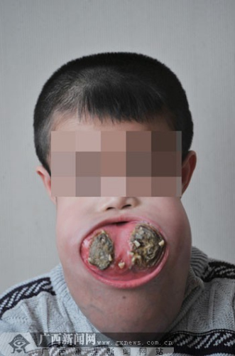 кǻͷ­ Ÿķɹ(ͼ)